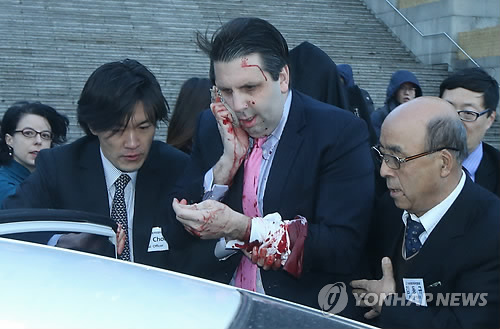 美国驻韩国大使李柏特5日上午遭到不明身份男子的袭击，脸部受重伤并造成大量出血，紧急被送往医院。（图片来源：韩联社）